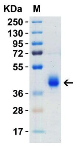 Novus Biologicals Recombinant SARS-CoV-2 Spike (RBD+SD1) His (C-Term) Protein 0.05 mg | Buy Online | Novus Biologicals&trade; | Fisher Scientific